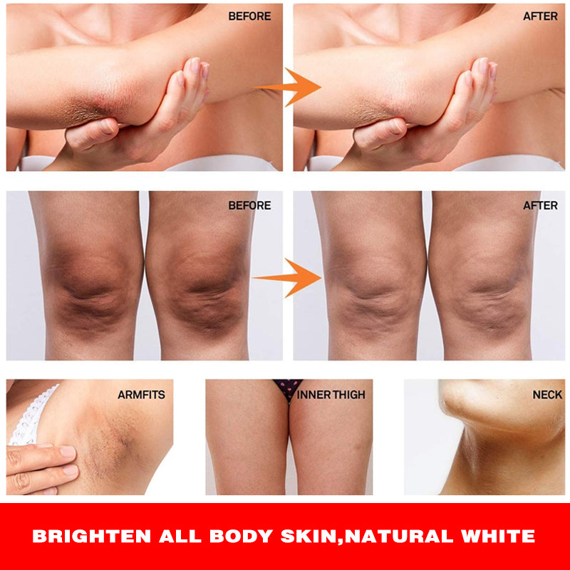 Vitamin Whitening Face & Body Cream – Brightening & Moisturizing Lotion