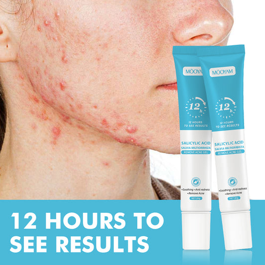 Salicylic Acid Acne Repair Gel – Anti-Spot &amp; Blemish Care Cream